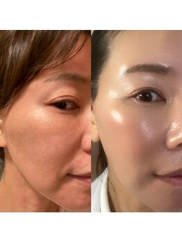 スターラッシュ(Star Lash)/水光肌作りは当店で◎