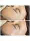 ジョリーワックス(jolie wax)の写真/ワックス脱毛でつるん！フェイシャルワックスで産毛・角質オフ、驚きのトーンアップで美白効果あり◎