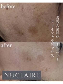 ここはな/シミまで目立たなく！