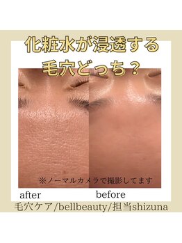 ベルビューティー(belle beauty)/毛穴洗浄☆お客様の結果！