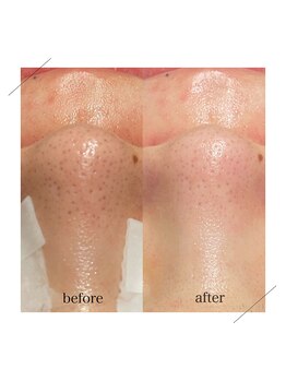 ベベクロスディディア 野々市市役所前店(Bebe×DiDiA)/お肌変化