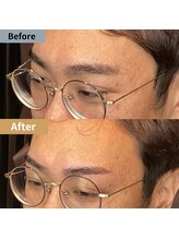 眉毛ハウス 吉祥寺店(眉毛HOUSE)/お客様の施術例(吉祥寺/東京)