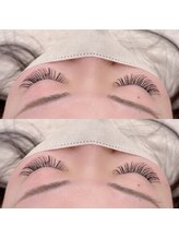 エン(EN)/ボリュームマツエク