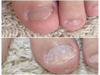 グレースレディ/ついむしっていまうフットも