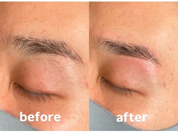 トップルック 横浜店(TOP LOOK)/メンズ眉毛ビフォーアフター