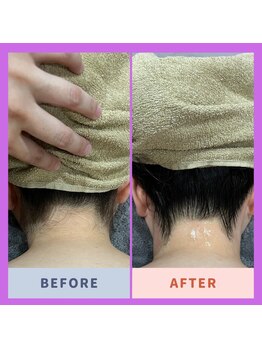 アヴァンス(AVANCE)/夏こそ!うなじのお手入れ