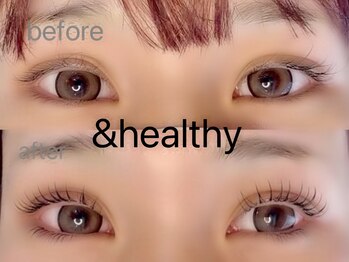 アネロ(anello)/&healthy