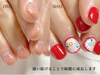 ウィッチ(witch)/深爪がひどい方も継続がカギ♪