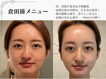 ラブミー 渋谷本店(LoveMe)の写真