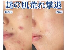 リアンシャンテ(Re enchanter)/