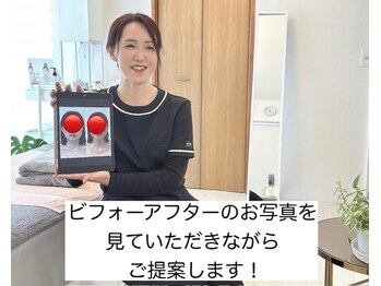 幸せ甦顔/ビフォーアフター写真