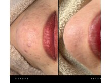 ワイケー(yk)/プラズマ４回