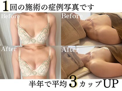 ビジュー(Be-joux)の写真