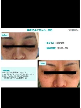 フェローズリンパケア(FELLOWS)/美白メニュー