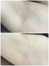 ルーメ(lume)/中学生女の子