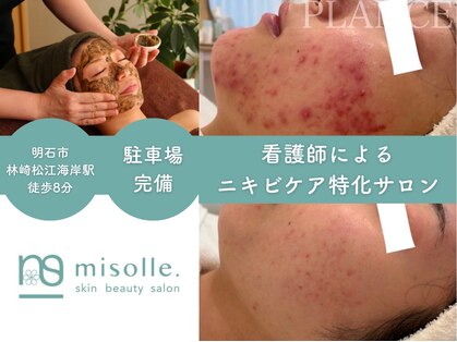 ミソル(misolle.)の写真