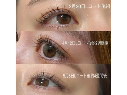 レア(lea)の写真