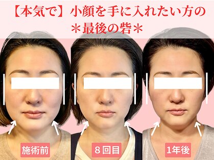 フレキシボディ(FlexiBody)の写真