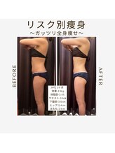 ビーシェイプ 君津(B-Shape)/【痩身】ビフォーアフター