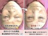 【日焼け前の美肌作り】顔全体+首 or うなじまでスッキリ美肌WAX 14300円→
