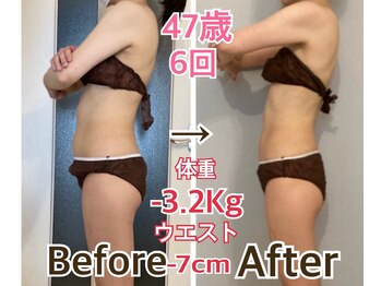 サロンドアン(Salon de an)/お客様の結果☆47歳(期間1ヶ月)