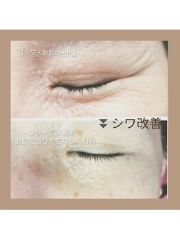 エタニティ(Eternity)/肌質改善!お悩み徹底改善!!