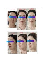 プライベートサロン 美月/炭酸パック7日間