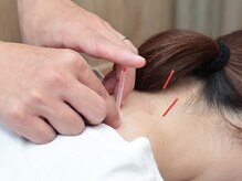 もりおか鍼灸接骨院 天王寺 阿倍野/