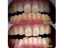 マゴイの雰囲気（Before→After）