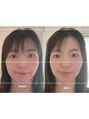 福多整体院 before/afterはフォトギャラリーやBLOGでCHECK！