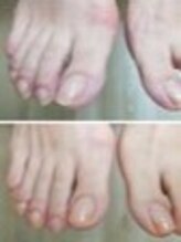 リゼラアンドコー 盛岡店/ドイツ式フットケア専門店