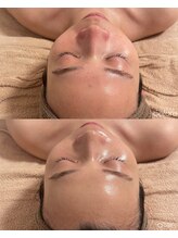 メロウ(mellou)/befove/after