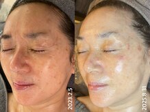 ラリマ(La-lima)の雰囲気（60代。年齢を重ねても素肌の美しさを高めることはできます。）