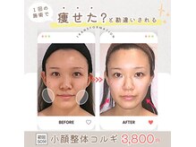 鹿児島市内で肩こりをリンパマッサージで改善し美姿勢に導く小顔矯正コルギの専門店の雰囲気（創業13周年!!100万人の施術実績★安心と信頼の当サロンへ！）