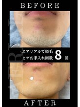 エアリアル 南行橋店/効果実感！お肌も印象も変わる