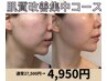 【たるみ/法令線/シワ】改善集中コース体験♪最短で若見え◎¥27500→¥4950