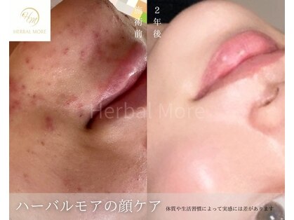 ソエルテの写真