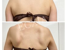 エクシア(ECXIA)/