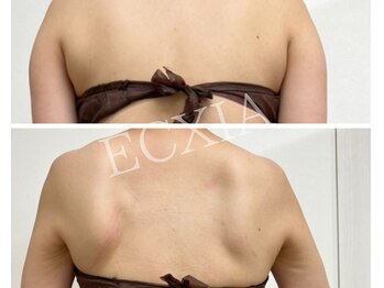 エクシア(ECXIA)/