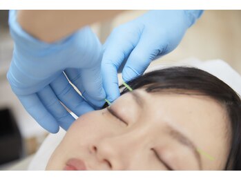 打出はり灸院 接骨院/美容鍼