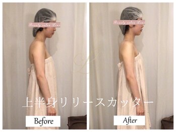 リノ(Lino)/上半身リリースカッターB&A