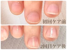 クロワ(croix)/美爪育成ネイルケア/5300円