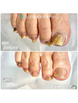 わずか4回目で劇的変化！