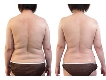 リムアール(Limh R)