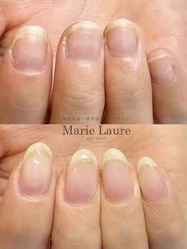 マリーロール 梅田店(Marie Laure)/自爪育成/深爪矯正/ネイルケア