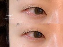 アノカプイル(ankpil)/8月【季節の定額aネイル】