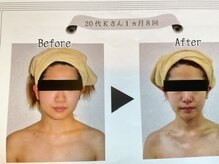 美活くらぶ/フェイシャル