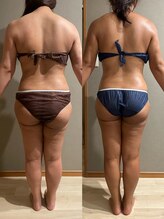 メロウ(me: llow)/恵比寿/ハイパーナイフEX