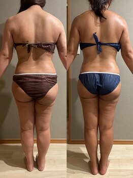 メロウ(me: llow)/恵比寿/ハイパーナイフEX