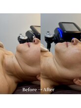 クリスタル(CRYSTAL)/レモンボトル